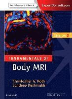 Fundamentals of Body MRI (hftad)