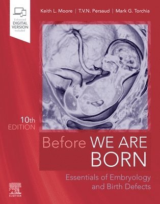 Before We Are Born (hftad)
