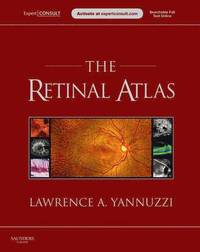 The Retinal Atlas (inbunden)