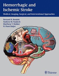 Hemorrhagic and Ischemic Stroke: Medical, Imaging, Surgical and Interventional Approaches (inbunden)