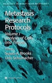 Metastasis Research Protocols (hftad)