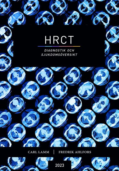 HRCT : diagnostik och sjukdomsversikt (hftad)