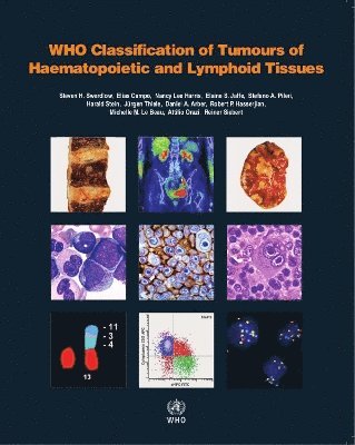 WHO classification of tumours of haematopoietic and lymphoid tissues (hftad)