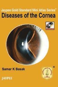 Jaypee Gold Standard Mini Atlas Series: Diseases of the Cornea (hftad)