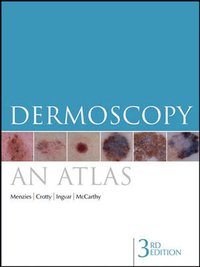 Dermoscopy - An Atlas (h�ftad)