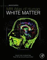 MRI Atlas of Human White Matter (inbunden)