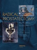 Radical Prostatectomy