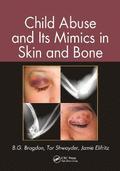Child Abuse and its Mimics in Skin and Bone