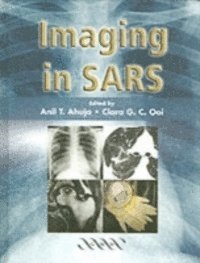 Imaging in SARS (h�ftad)