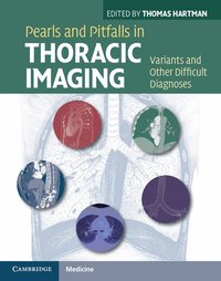 Pearls and Pitfalls in Thoracic Imaging (inbunden)