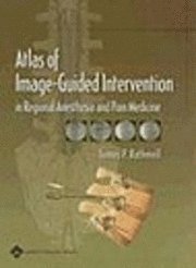 Atlas of Image-guided Intervention in Regional Anesthesia and Pain Medicine (inbunden)