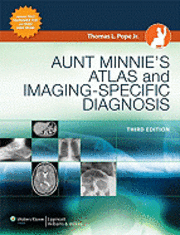 Aunt Minnie's Atlas and Imaging-specific Diagnosis (inbunden)
