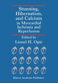 Stunning, Hibernation and Calcium in Myocardial Ischemia and Reperfusion (h�ftad)