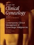 Atlas of Clinical Gynecology: Contemporary Clinical Management of Gynecologic Malignancies