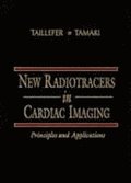 New Radiotracers in Cardiac Imaging: Principles and Applications