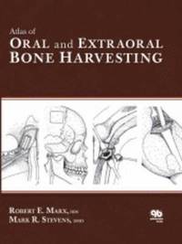 Atlas of Oral and Extraoral Bone Harvesting (inbunden)