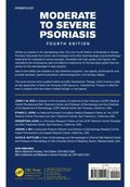 Moderate to Severe Psoriasis