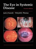 Eye in Systemic Disease