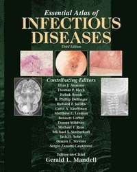 Essential Atlas of Infectious Diseases (inbunden)