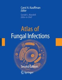 Atlas of Fungal Infection (inbunden)