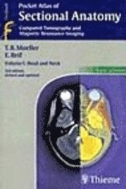 Pocket Atlas of Sectional Anatomy, Volume 1: Head and Neck (h�ftad)