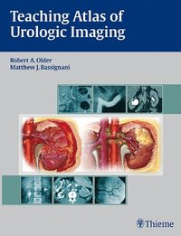 Teaching Atlas of Urologic Imaging (inbunden)