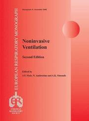 Noninvasive Ventilation (inbunden)