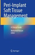 Peri-Implant Soft Tissue Management