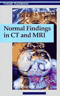 Normal Findings in CT and MRI (h�ftad)
