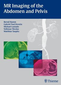 MR Imaging of the Abdomen and Pelvis (inbunden)