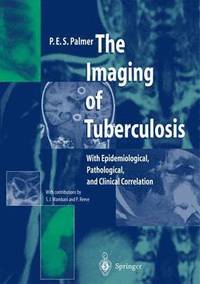 The Imaging of Tuberculosis (h�ftad)
