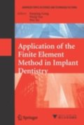 Application of the Finite Element Method in Implant Dentistry