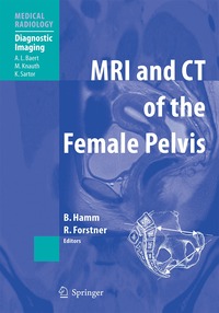 MRI and CT of the Female Pelvis (inbunden)