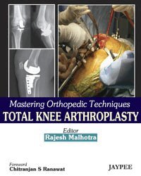 Mastering Orthopedic Techniques Total Knee Arthroplasty (inbunden)