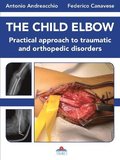 The Child Elbow