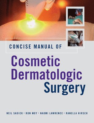 Concise Manual of Cosmetic Dermatologic Surgery (inbunden)