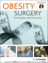 Obesity Surgery: Principles and Practice (e-bok)