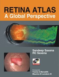 Retina Atlas: A Global Perspective (inbunden)