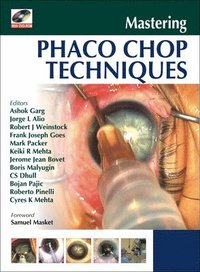 Mastering Phaco Chop Techniques (inbunden)