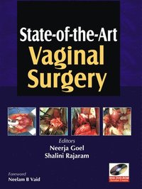 State-of-the-Art Vaginal Surgery (inbunden)