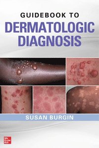 Guidebook to Dermatologic Diagnosis (hftad)