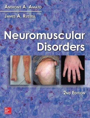 Neuromuscular Disorders (häftad)