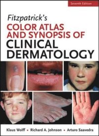 Fitzpatricks Color Atlas and Synopsis of Clinical Dermatology, Seventh Edition (e-bok)
