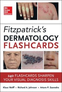 Fitzpatricks Dermatology Flash Cards (häftad)