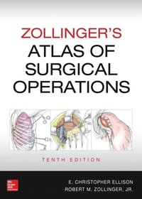 Zollinger's Atlas of Surgical Operations, 10th edition (e-bok)