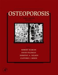 Osteoporosis (e-bok)