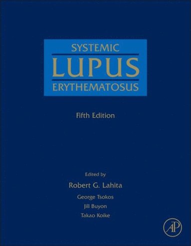 Systemic Lupus Erythematosus (e-bok)