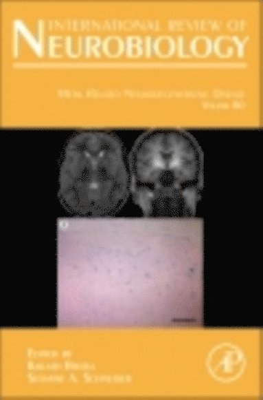 Metal Related Neurodegenerative Disease (h�ftad)