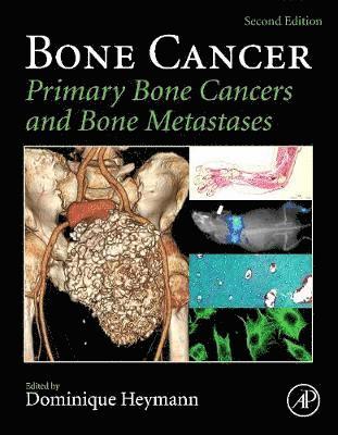 Bone Cancer (inbunden)