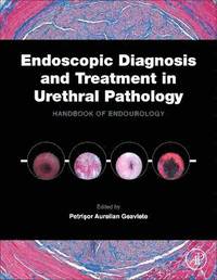 Endoscopic Diagnosis and Treatment in Urethral Pathology (inbunden)